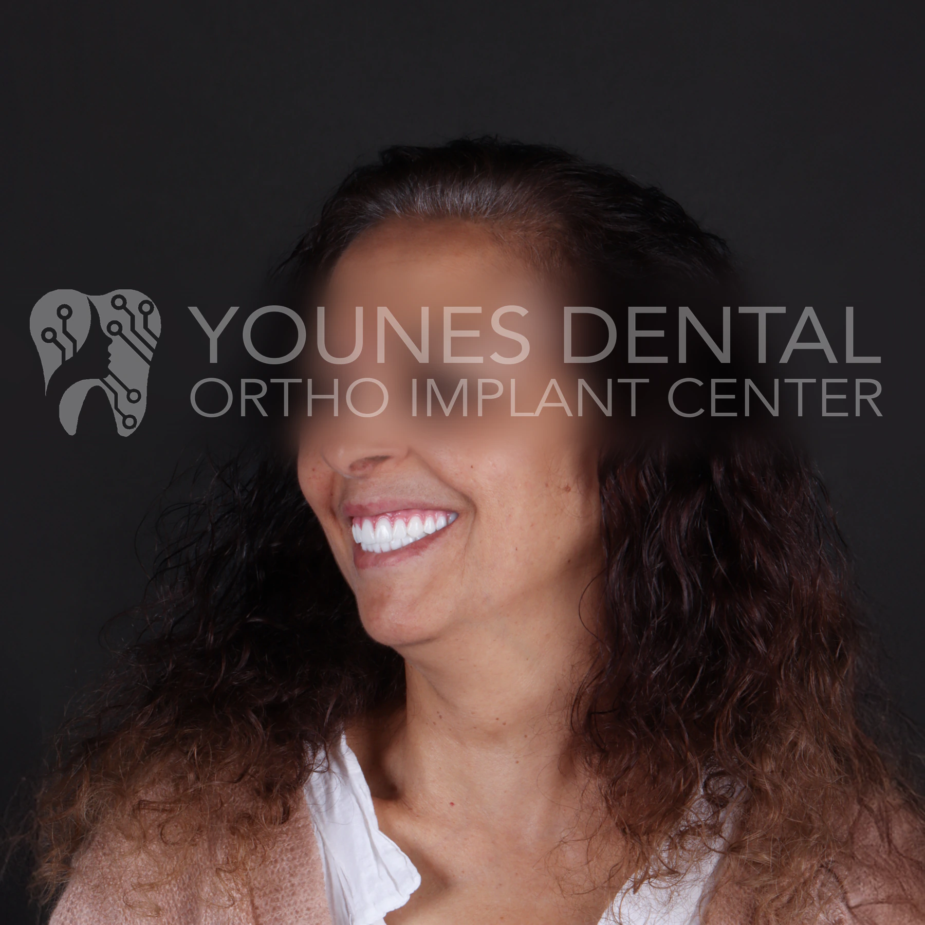 All on 4 — patient result